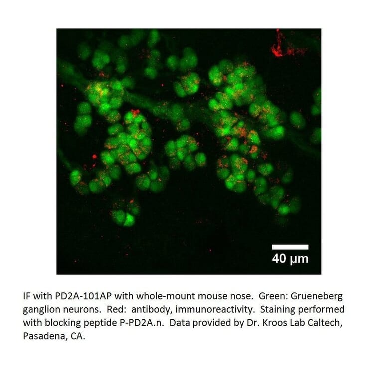 Anti-PDE2A Antibody from FabGennix (PD2A-101AP) - Antibodies.com