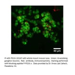 Anti-PDE2A Antibody from FabGennix (PD2A-101AP) - Antibodies.com