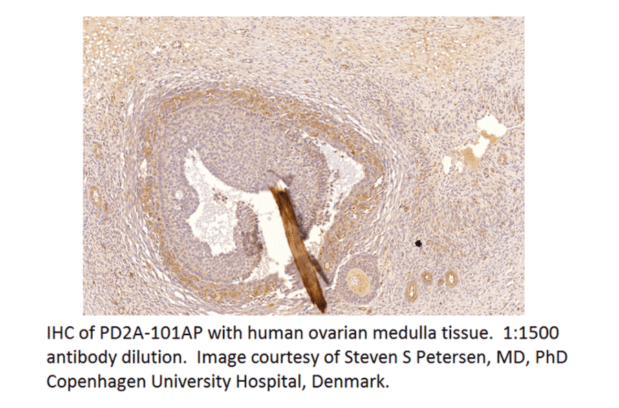 Anti-PDE2A Antibody from FabGennix (PD2A-101AP) - Antibodies.com