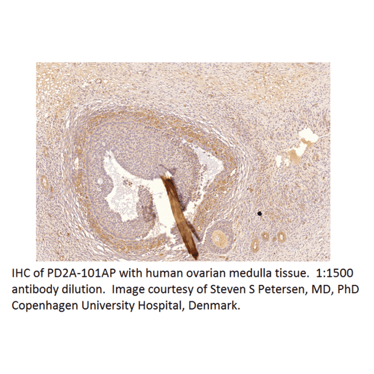 Anti-PDE2A Antibody from FabGennix (PD2A-101AP) - Antibodies.com
