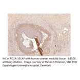 Anti-PDE2A Antibody from FabGennix (PD2A-101AP) - Antibodies.com