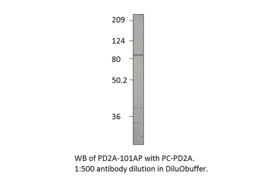 Anti-PDE2A Antibody from FabGennix (PD2A-101AP) - Antibodies.com