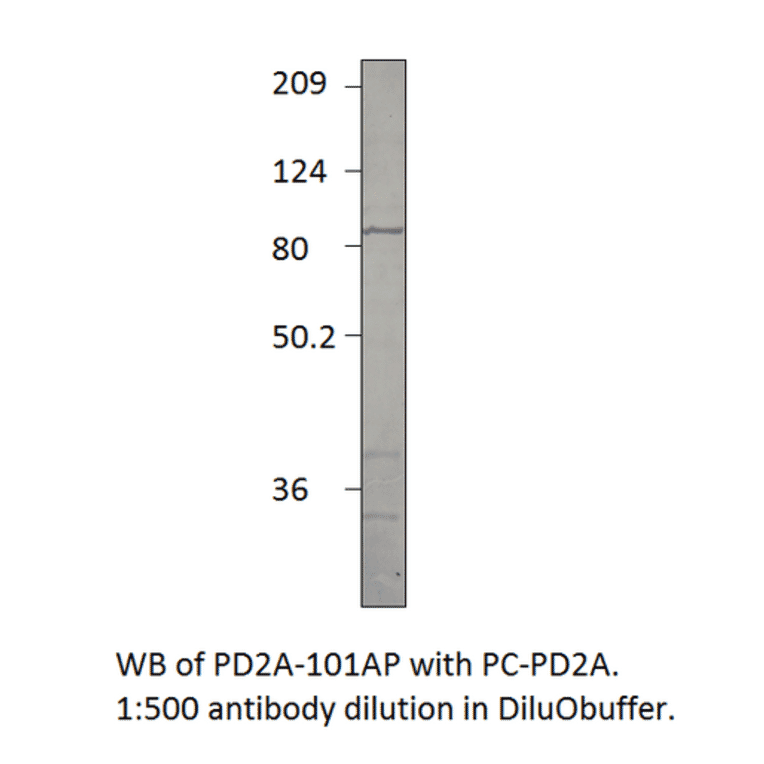 Anti-PDE2A Antibody from FabGennix (PD2A-101AP) - Antibodies.com