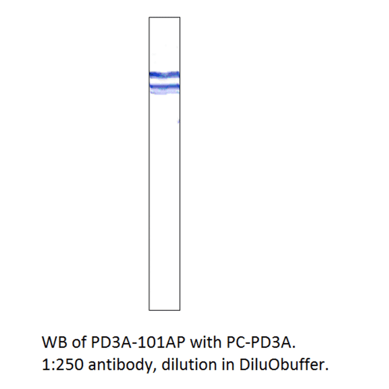 Anti-PDE3A Antibody from FabGennix (PD3A-112AP) - Antibodies.com