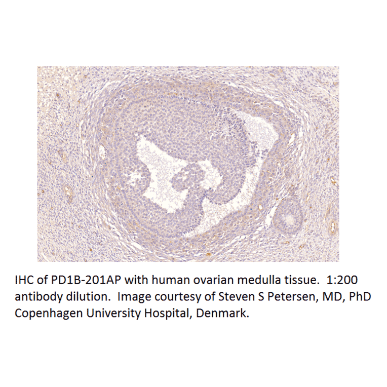 Anti-PDE3B Antibody from FabGennix (PD3B-101AP) - Antibodies.com