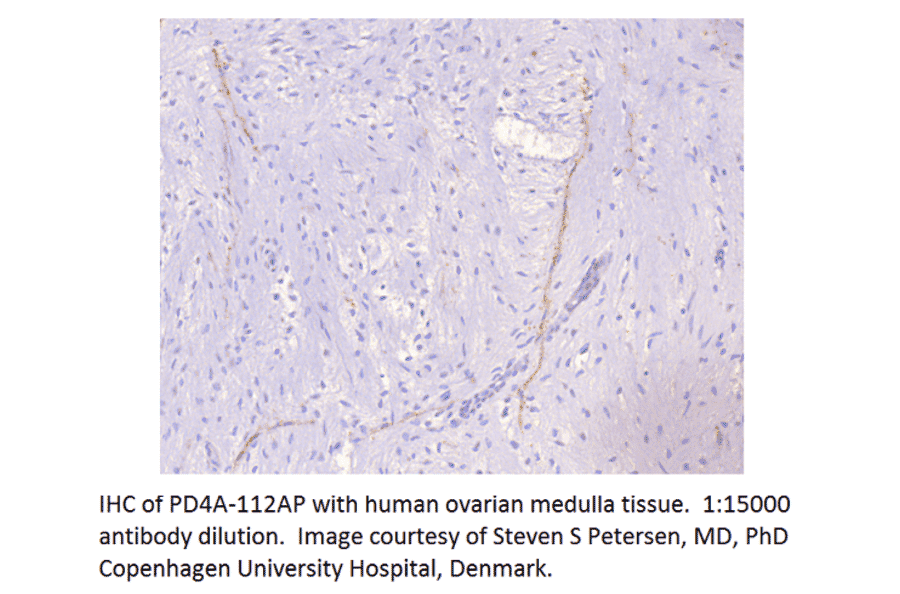 Anti-PDE4A Antibody from FabGennix (PD4A-112AP) - Antibodies.com