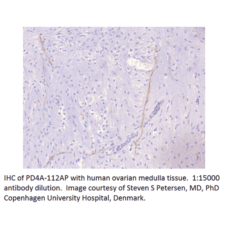 Anti-PDE4A Antibody from FabGennix (PD4A-112AP) - Antibodies.com