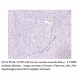 Anti-PDE4A Antibody from FabGennix (PD4A-112AP) - Antibodies.com