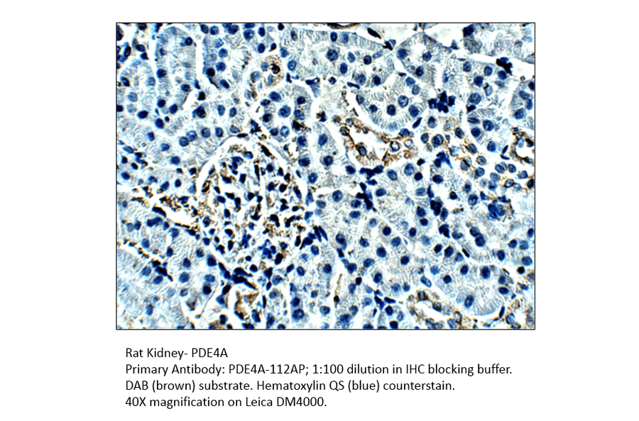 Anti-PDE4A Antibody from FabGennix (PD4A-112AP) - Antibodies.com