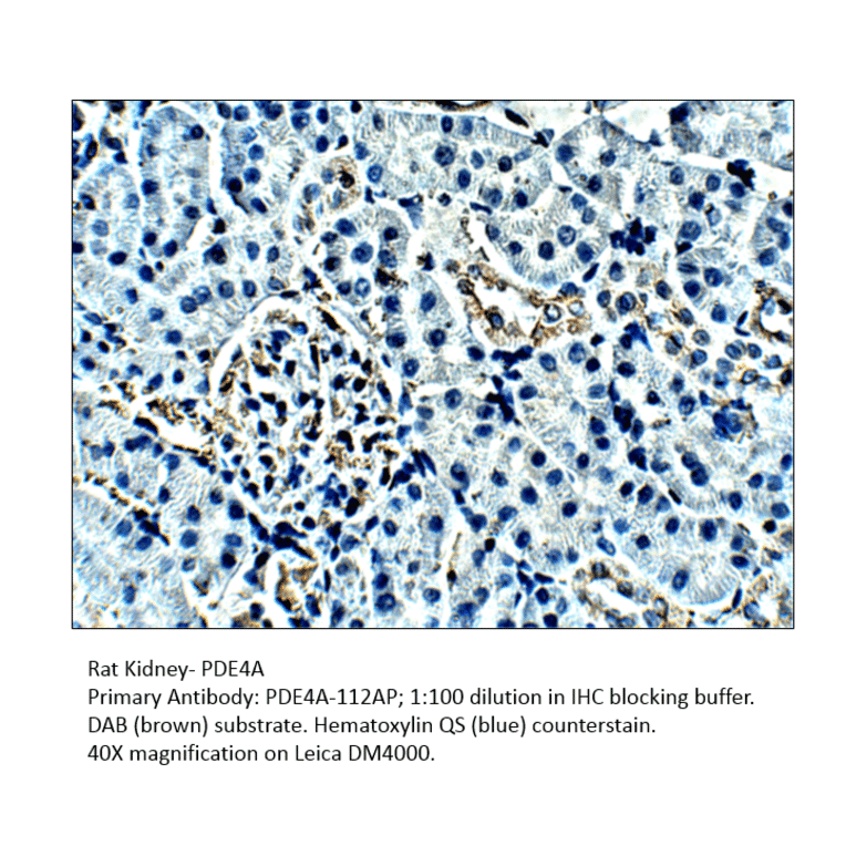 Anti-PDE4A Antibody from FabGennix (PD4A-112AP) - Antibodies.com