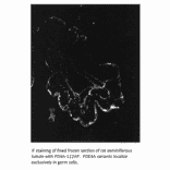 Anti-PDE4A Antibody from FabGennix (PD4A-112AP) - Antibodies.com