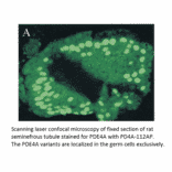 Anti-PDE4A Antibody from FabGennix (PD4A-112AP) - Antibodies.com
