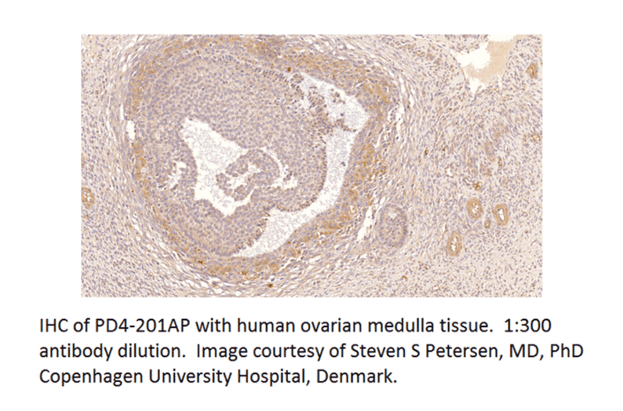 Anti-PDE4B Antibody from FabGennix (PD4B-201AP) - Antibodies.com