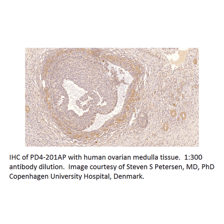 Anti-PDE4B Antibody from FabGennix (PD4B-201AP) - Antibodies.com