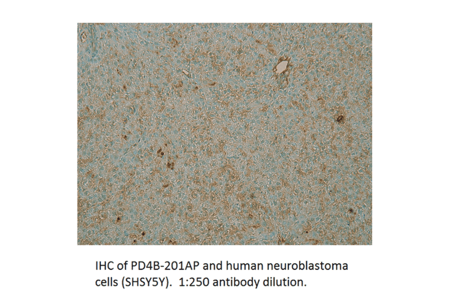 Anti-PDE4B Antibody from FabGennix (PD4B-201AP) - Antibodies.com