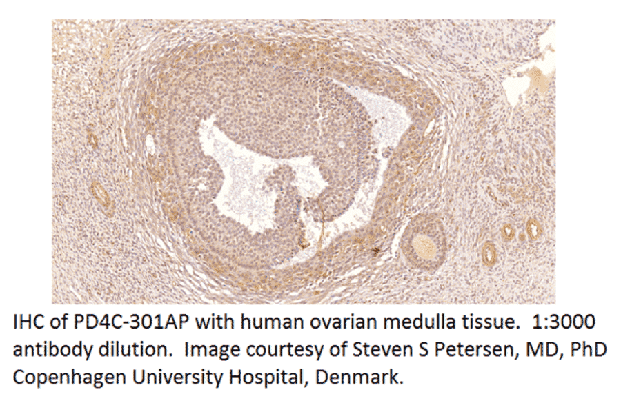 Anti-PDE4C Antibody from FabGennix (PD4C-301AP) - Antibodies.com