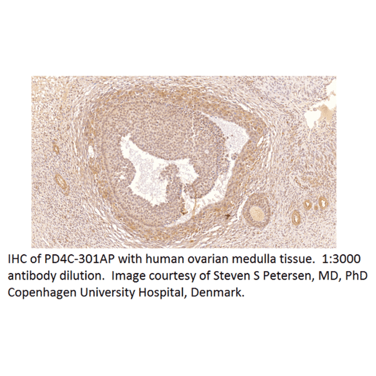 Anti-PDE4C Antibody from FabGennix (PD4C-301AP) - Antibodies.com