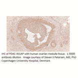 Anti-PDE4C Antibody from FabGennix (PD4C-301AP) - Antibodies.com