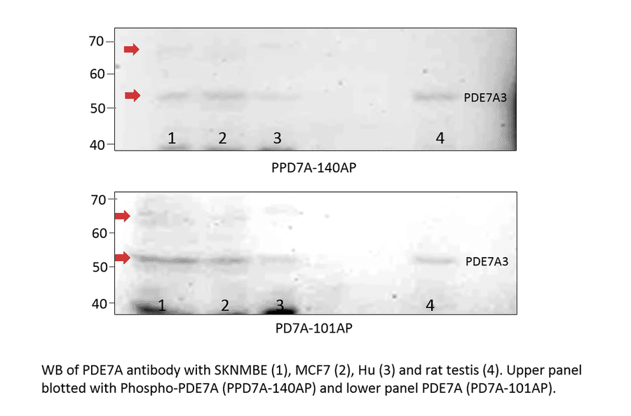 Anti-PDE7A Antibody from FabGennix (PD7A-101AP) - Antibodies.com