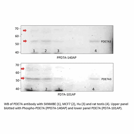 Anti-PDE7A Antibody from FabGennix (PD7A-101AP) - Antibodies.com