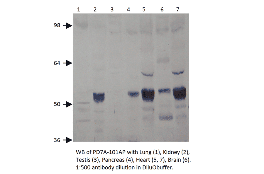 Anti-PDE7A Antibody from FabGennix (PD7A-101AP) - Antibodies.com