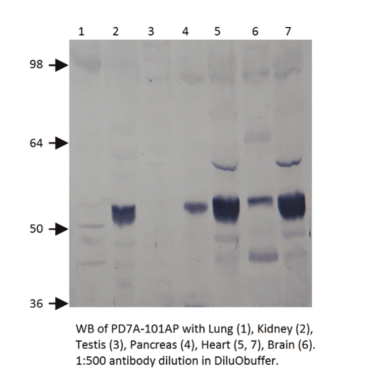 Anti-PDE7A Antibody from FabGennix (PD7A-101AP) - Antibodies.com