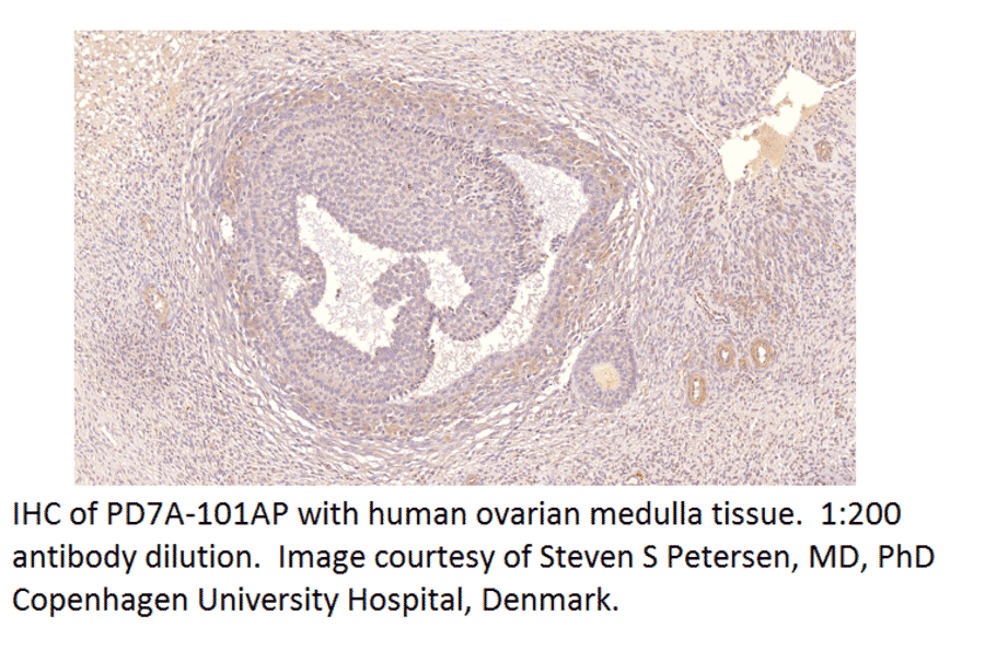 Anti-PDE7A Antibody from FabGennix (PD7A-101AP) - Antibodies.com