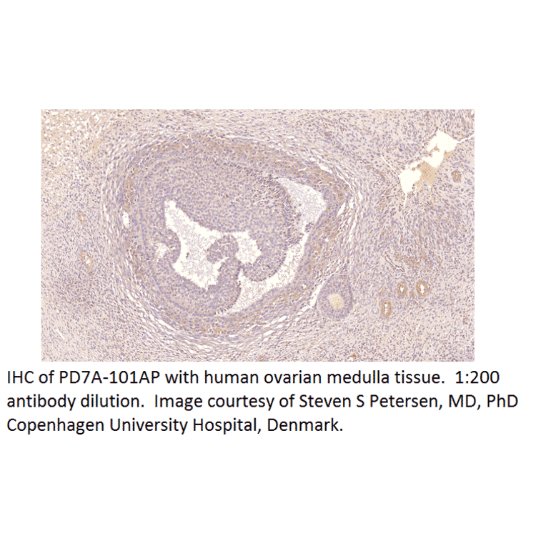 Anti-PDE7A Antibody from FabGennix (PD7A-101AP) - Antibodies.com