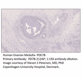 Anti-PDE7B Antibody from FabGennix (PD7B-212AP) - Antibodies.com