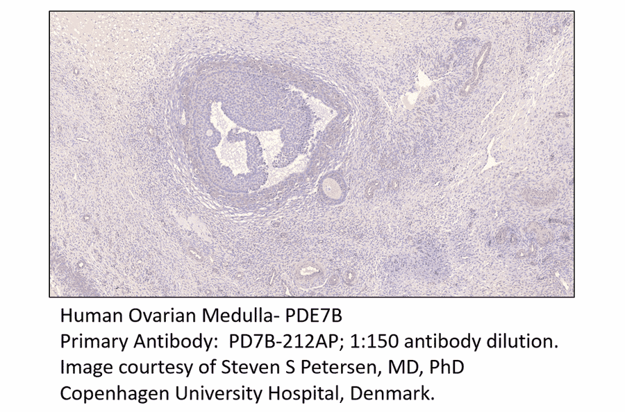 Anti-PDE7B Antibody from FabGennix (PD7B-212AP) - Antibodies.com