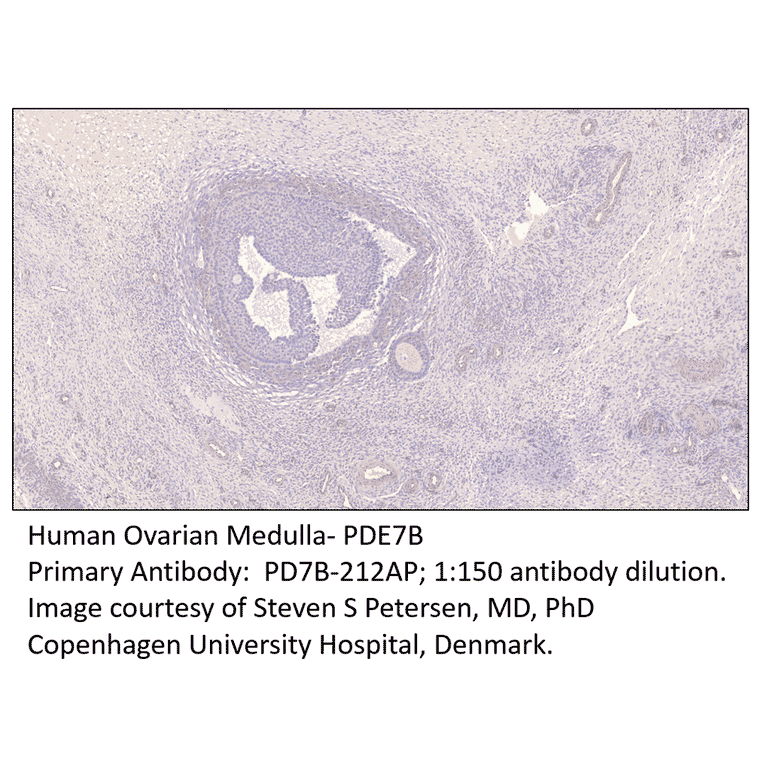 Anti-PDE7B Antibody from FabGennix (PD7B-212AP) - Antibodies.com