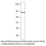 Anti-PDE7B Antibody from FabGennix (PD7B-212AP) - Antibodies.com