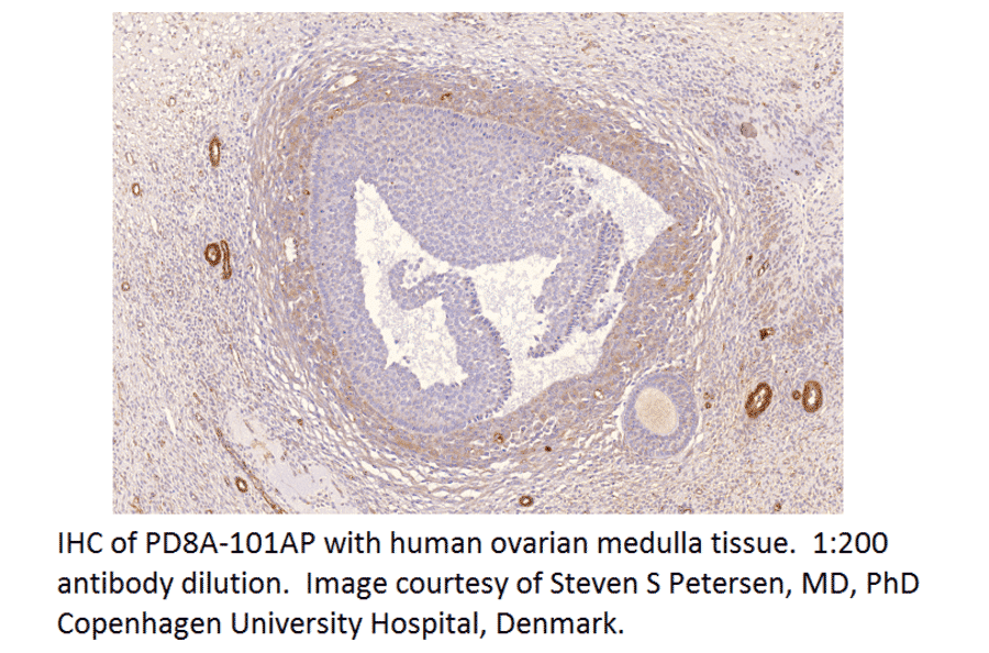 Anti-PDE8A Antibody from FabGennix (PD8A-101AP) - Antibodies.com