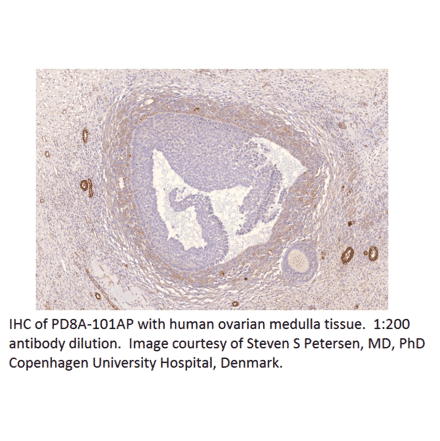 Anti-PDE8A Antibody from FabGennix (PD8A-101AP) - Antibodies.com