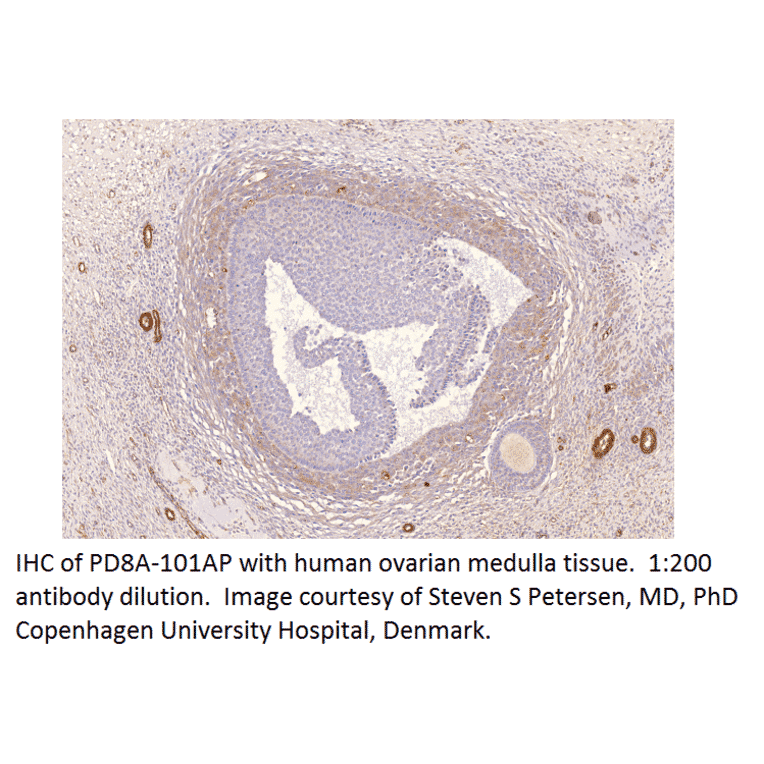 Anti-PDE8A Antibody from FabGennix (PD8A-101AP) - Antibodies.com