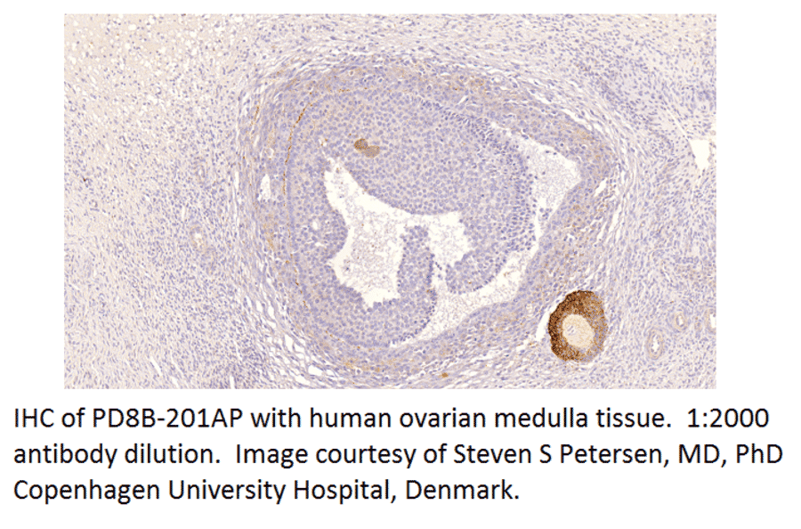 Anti-PDE8B Antibody from FabGennix (PD8B-201AP) - Antibodies.com