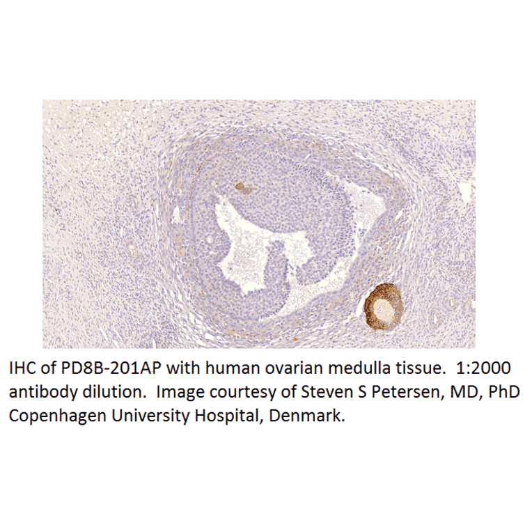 Anti-PDE8B Antibody from FabGennix (PD8B-201AP) - Antibodies.com
