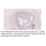 Anti-PDE8B Antibody from FabGennix (PD8B-201AP) - Antibodies.com