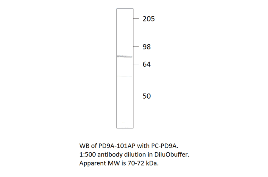 Anti-PDE9A Antibody from FabGennix (PD9A-101AP) - Antibodies.com