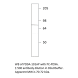 Anti-PDE9A Antibody from FabGennix (PD9A-101AP) - Antibodies.com