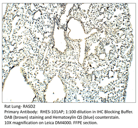 Anti-RASD2 Antibody from FabGennix (RHES-101AP) - Antibodies.com