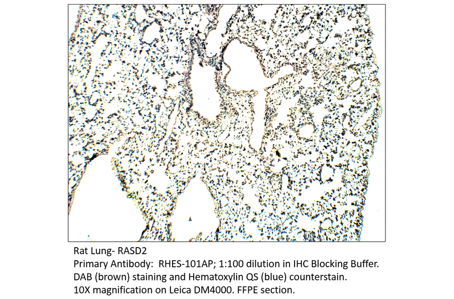 Anti-RASD2 Antibody from FabGennix (RHES-101AP) - Antibodies.com