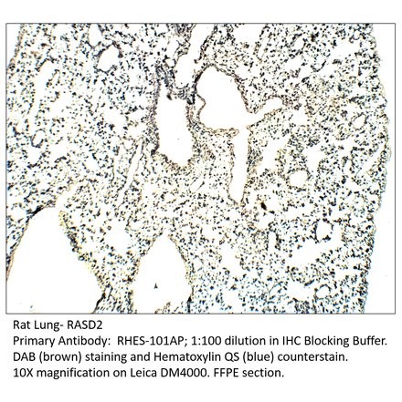 Anti-RASD2 Antibody from FabGennix (RHES-101AP) - Antibodies.com