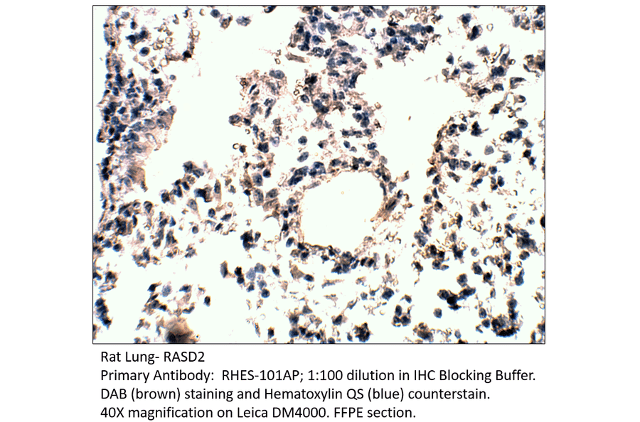 Anti-RASD2 Antibody from FabGennix (RHES-101AP) - Antibodies.com