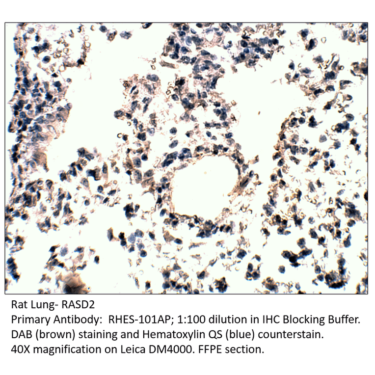 Anti-RASD2 Antibody from FabGennix (RHES-101AP) - Antibodies.com