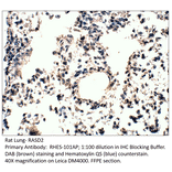 Anti-RASD2 Antibody from FabGennix (RHES-101AP) - Antibodies.com