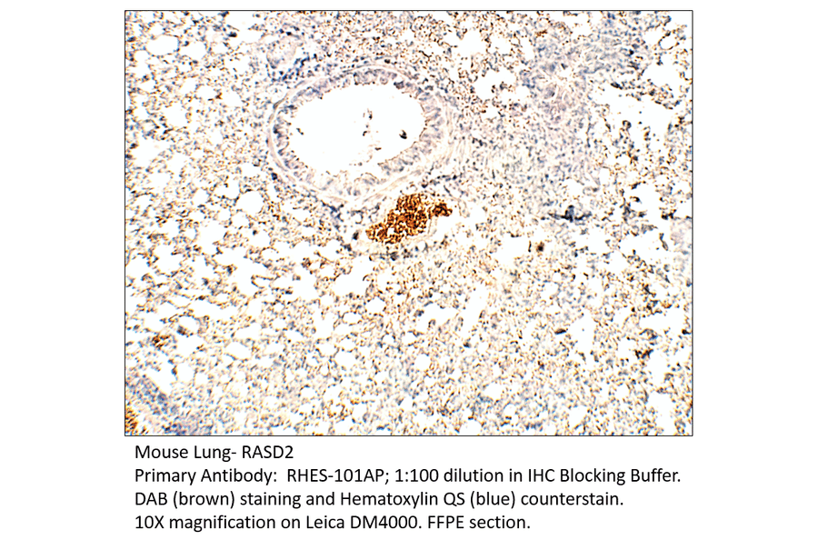 Anti-RASD2 Antibody from FabGennix (RHES-101AP) - Antibodies.com