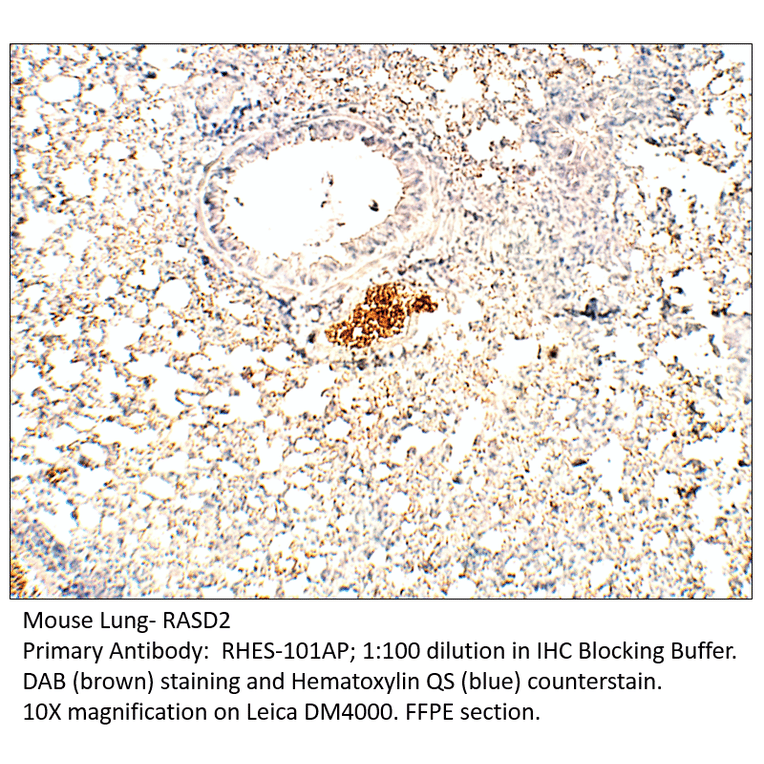 Anti-RASD2 Antibody from FabGennix (RHES-101AP) - Antibodies.com