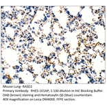 Anti-RASD2 Antibody from FabGennix (RHES-101AP) - Antibodies.com
