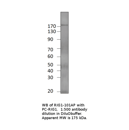 Anti-Robo3 Antibody from FabGennix (RIG1-101AP) - Antibodies.com